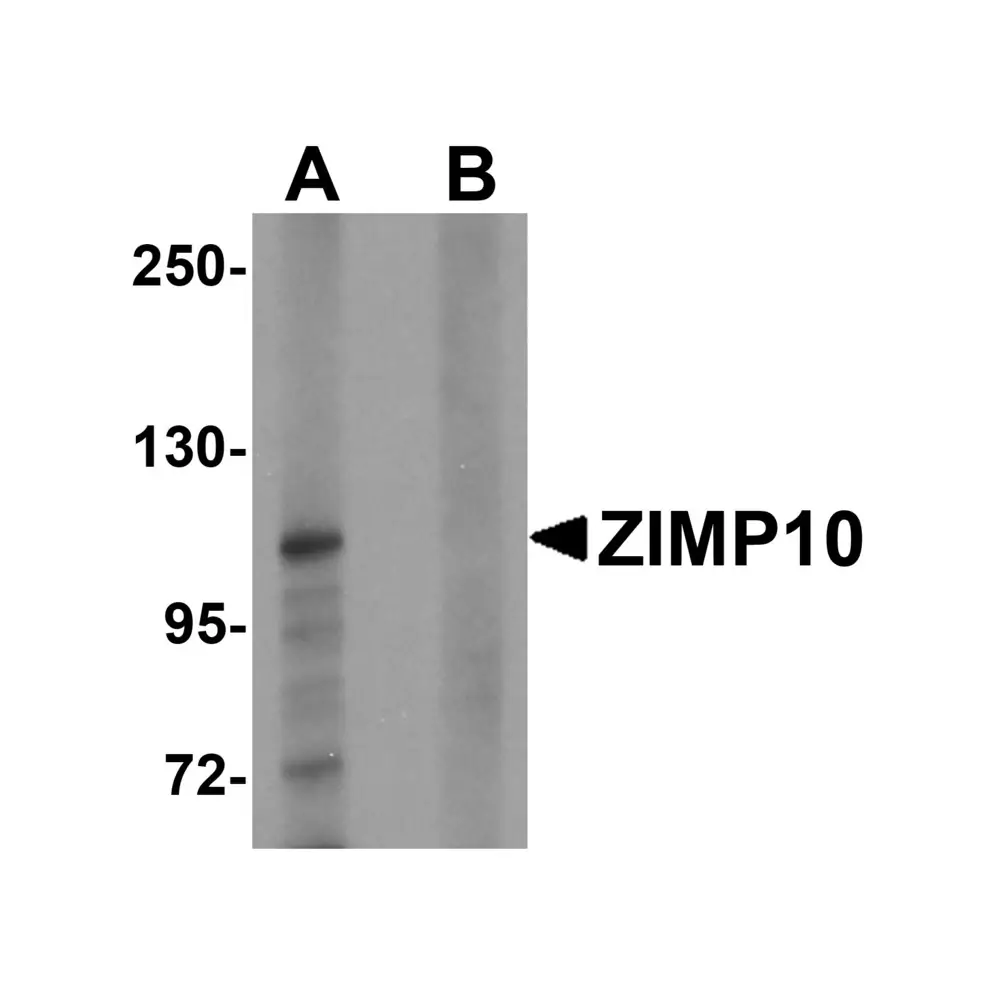 ProSci 6237 ZIMP10 Antibody, ProSci, 0.1 mg/Unit Primary Image