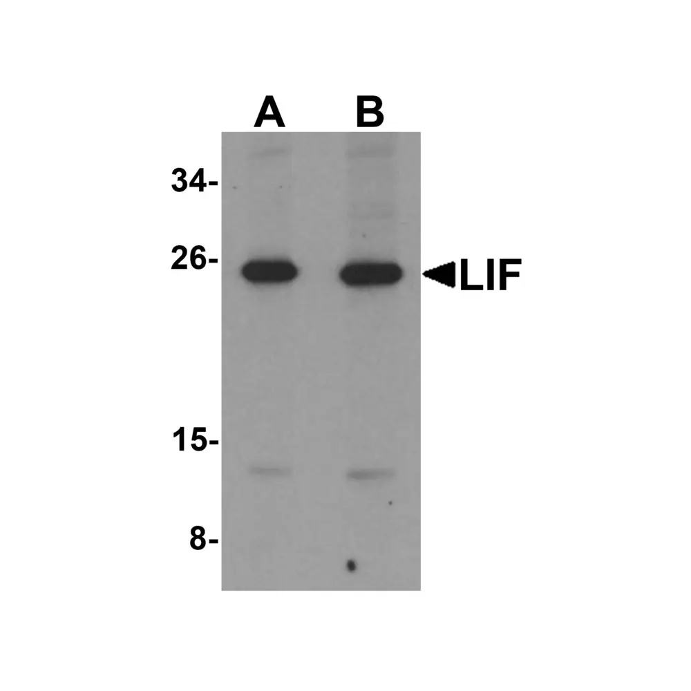 ProSci 6245_S LIF Antibody, ProSci, 0.02 mg/Unit Primary Image