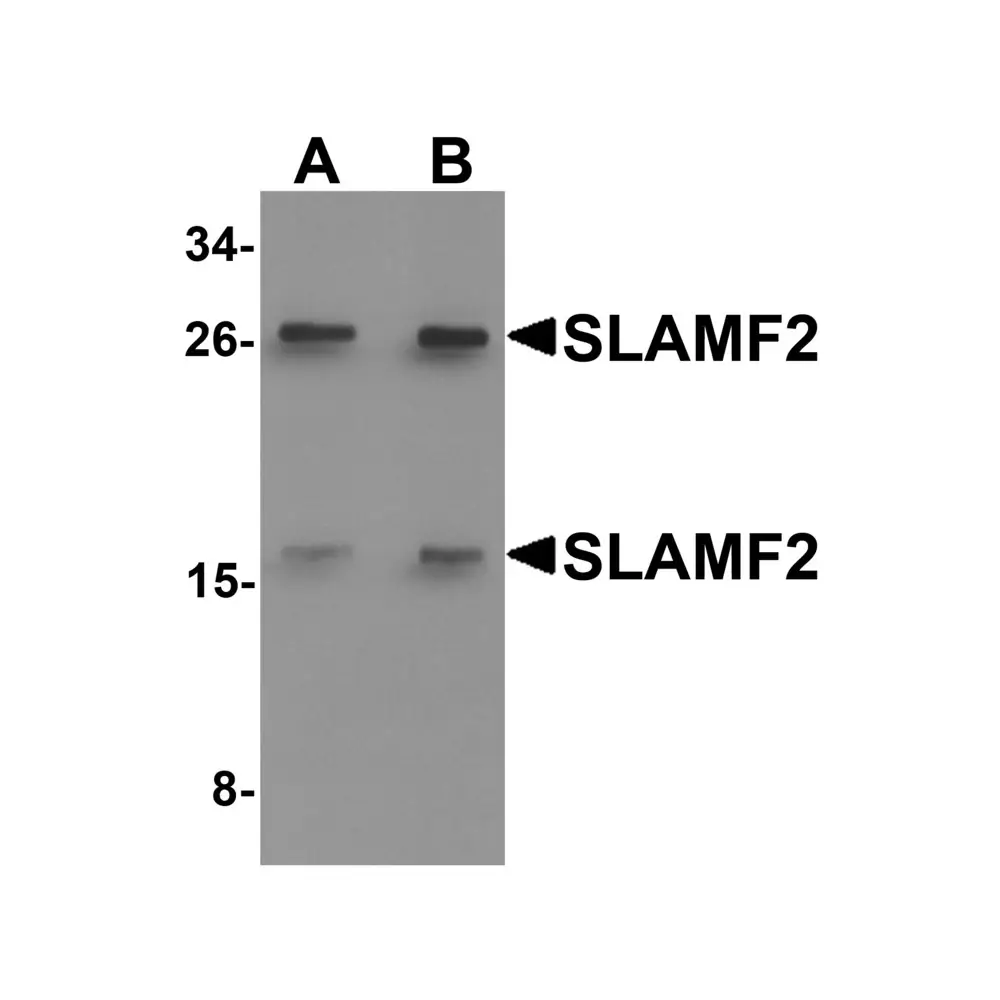 ProSci 6249_S SLAMF2 Antibody, ProSci, 0.02 mg/Unit Primary Image