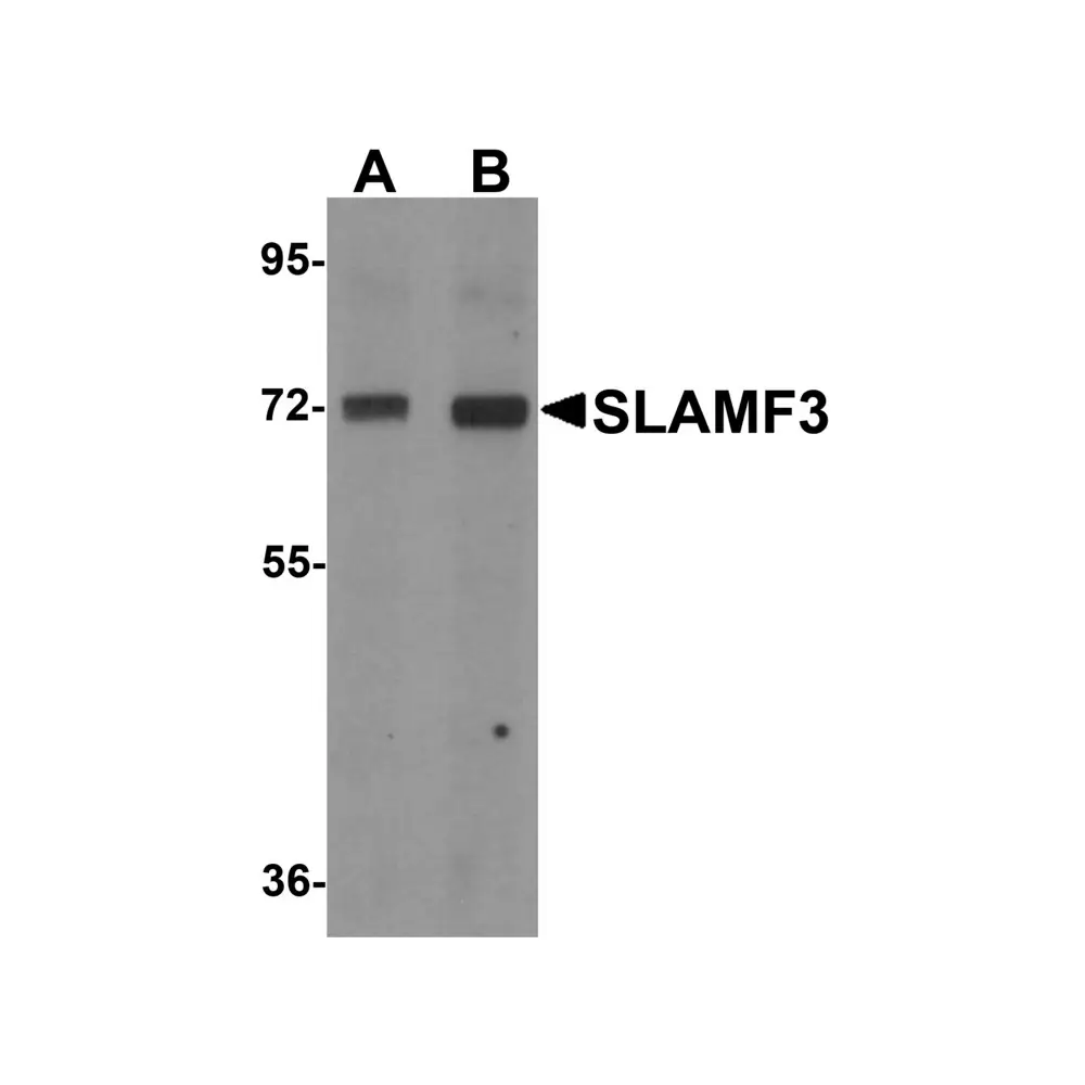 ProSci 6251_S SLAMF3 Antibody, ProSci, 0.02 mg/Unit Primary Image