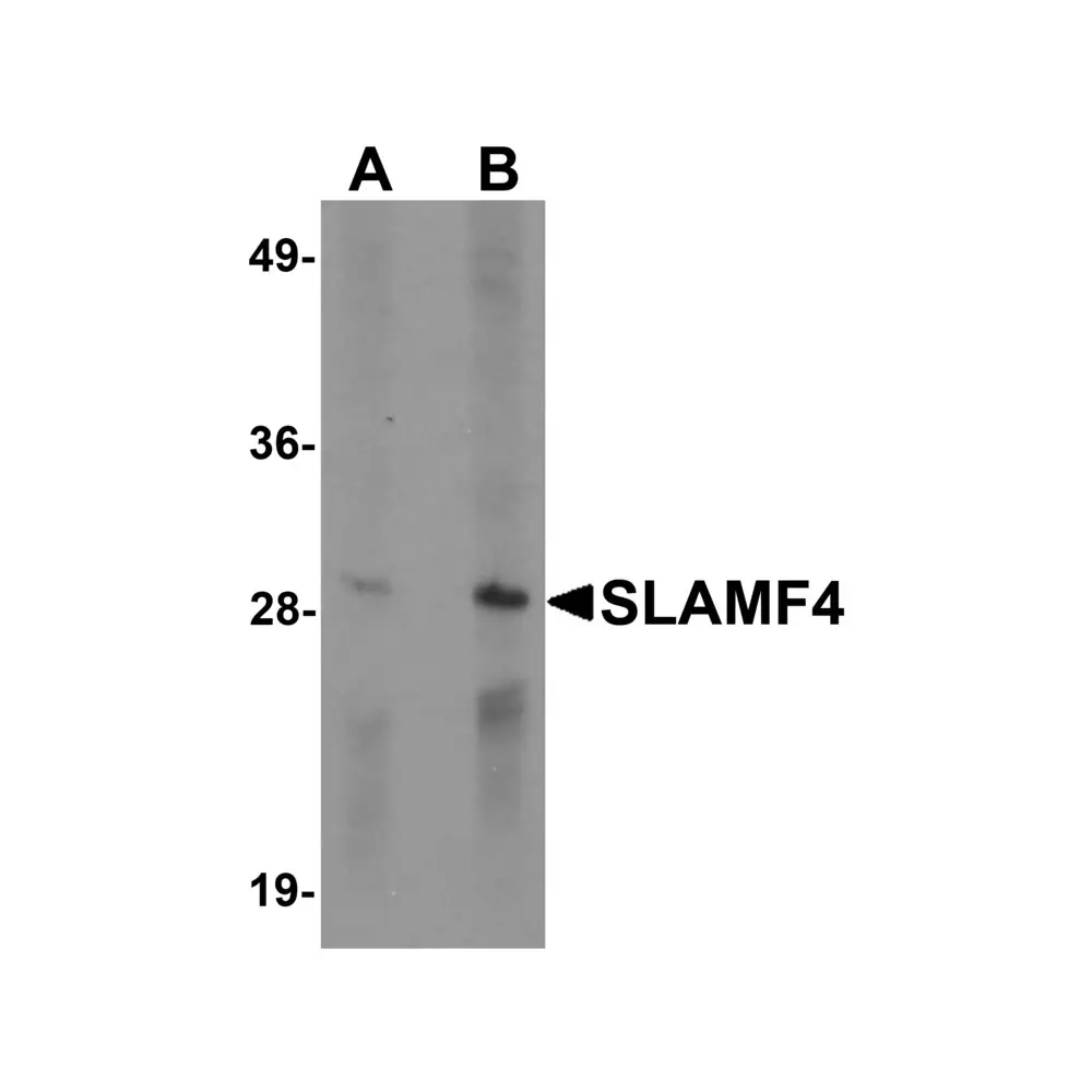 ProSci 6253 SLAMF4 Antibody, ProSci, 0.1 mg/Unit Primary Image