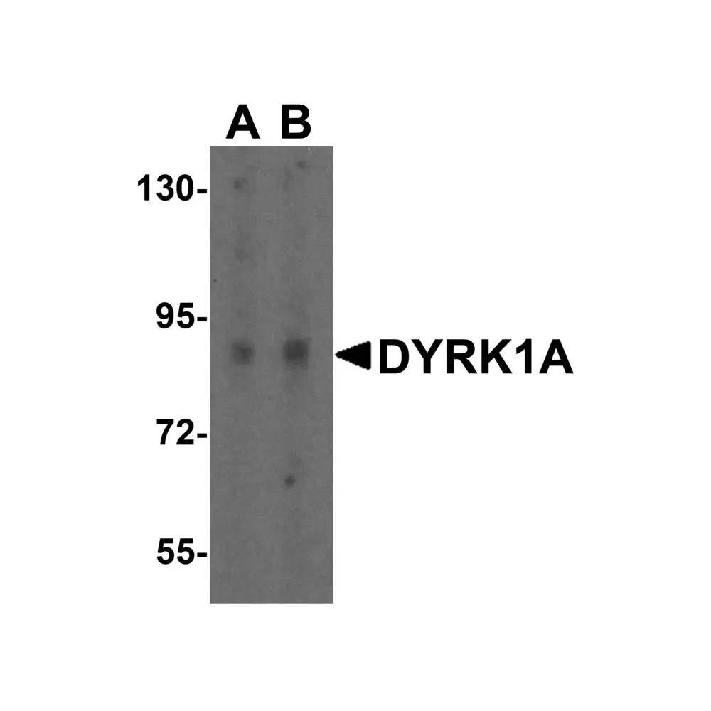 ProSci 6255_S DYRK1A Antibody, ProSci, 0.02 mg/Unit Primary Image