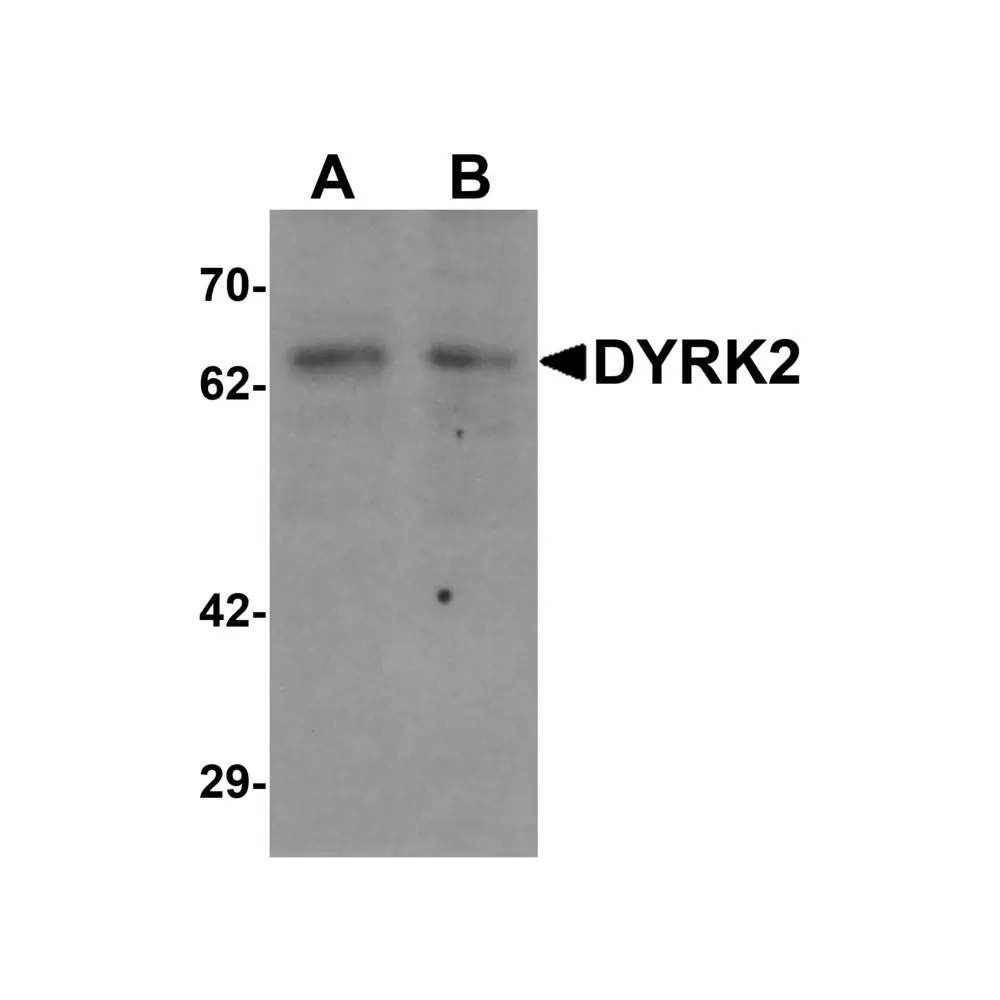 ProSci 6257_S DYRK2 Antibody, ProSci, 0.02 mg/Unit Primary Image