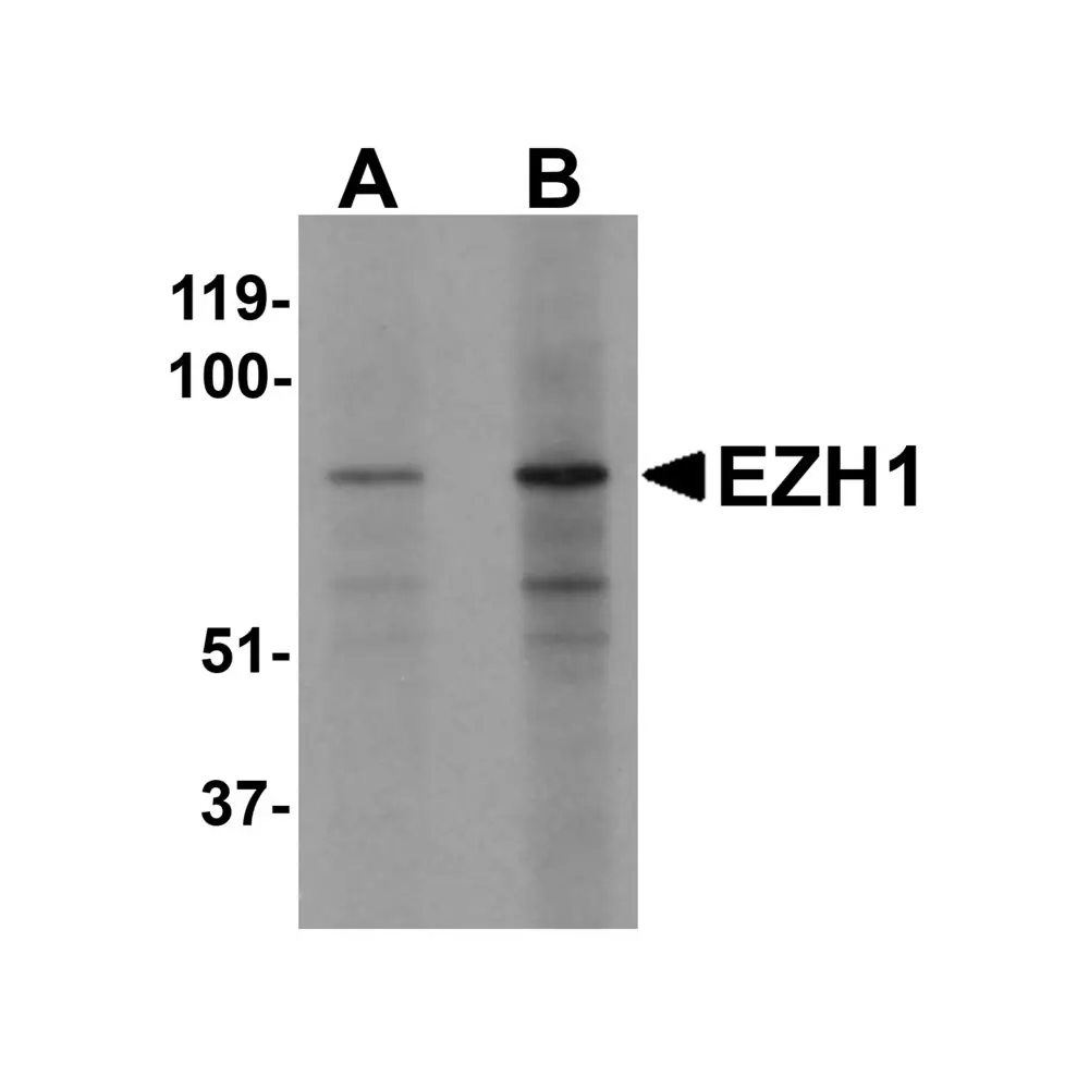 ProSci 6261 EZH1 Antibody, ProSci, 0.1 mg/Unit Primary Image