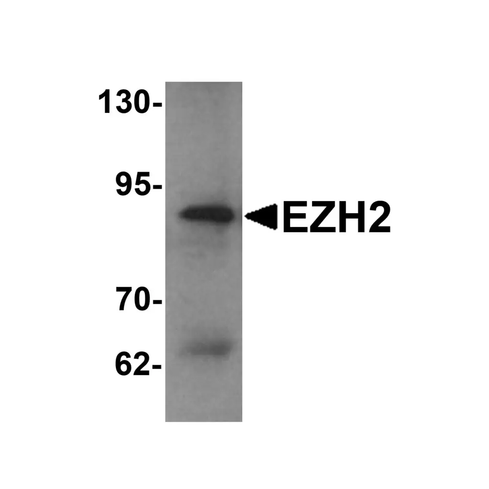 ProSci 6263_S EZH2 Antibody, ProSci, 0.02 mg/Unit Primary Image