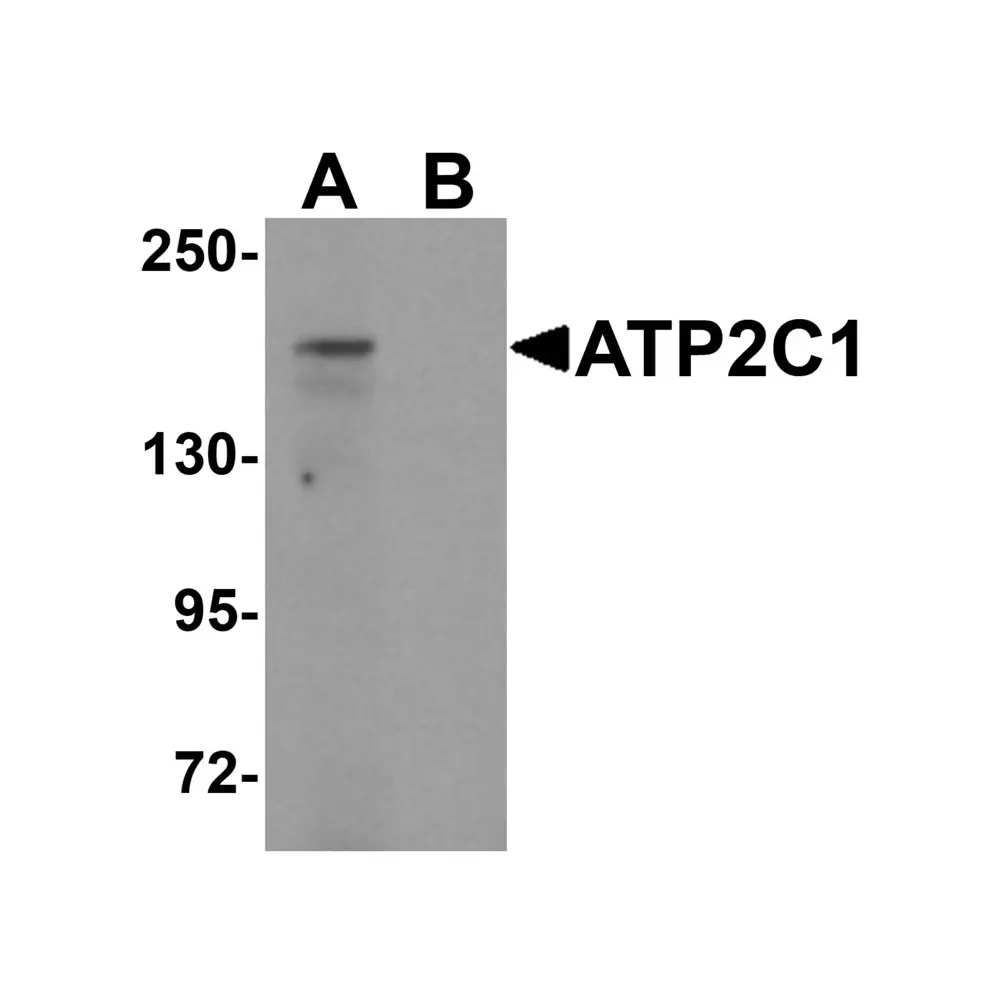 ProSci 6287_S ATP2C1 Antibody, ProSci, 0.02 mg/Unit Primary Image