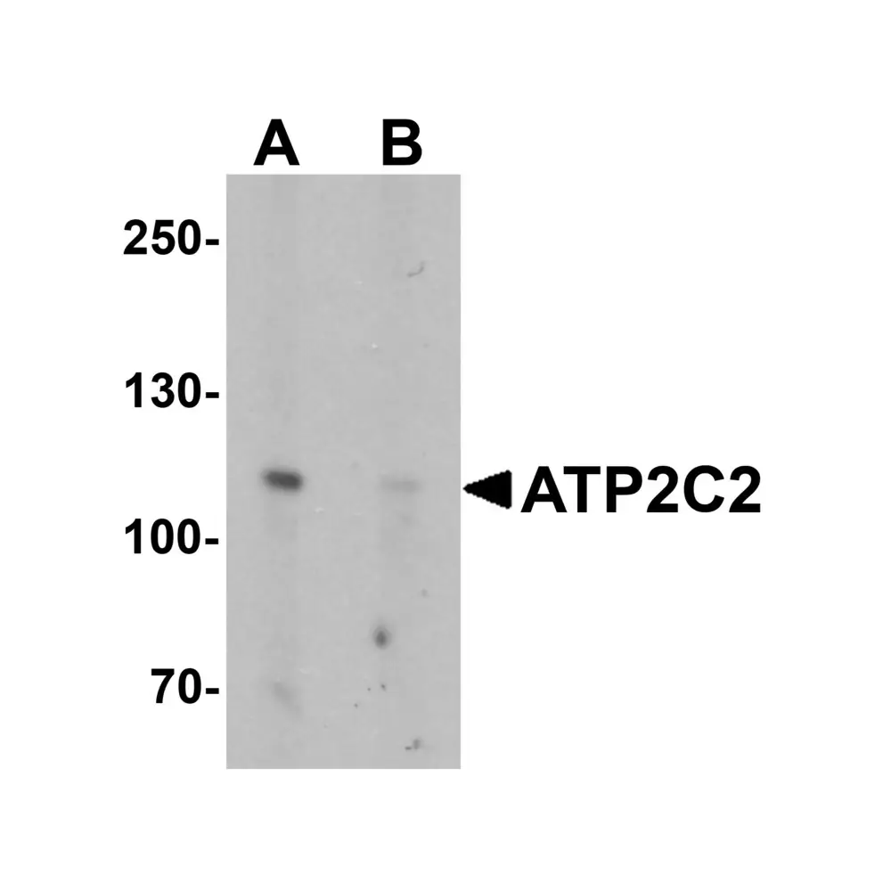 ProSci 6289 ATP2C2 Antibody, ProSci, 0.1 mg/Unit Primary Image