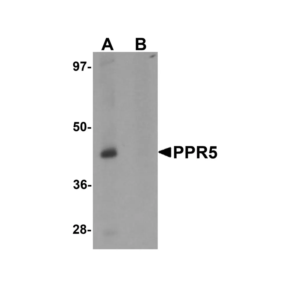 ProSci 6291 PRR5 Antibody, ProSci, 0.1 mg/Unit Primary Image