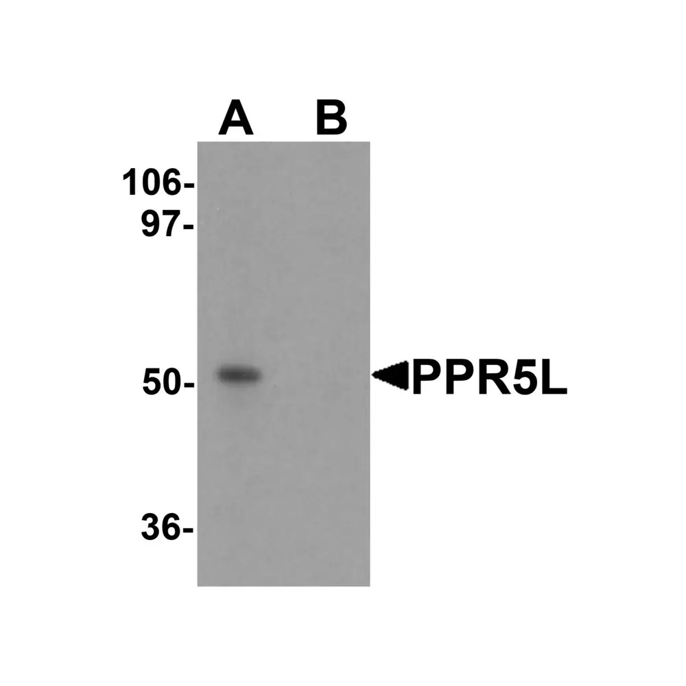 ProSci 6293_S PRR5L Antibody, ProSci, 0.02 mg/Unit Primary Image