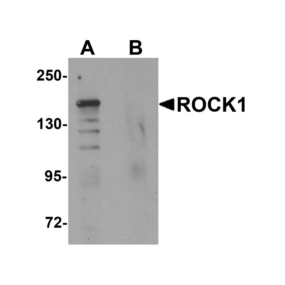 ProSci 6295_S ROCK1 Antibody, ProSci, 0.02 mg/Unit Primary Image