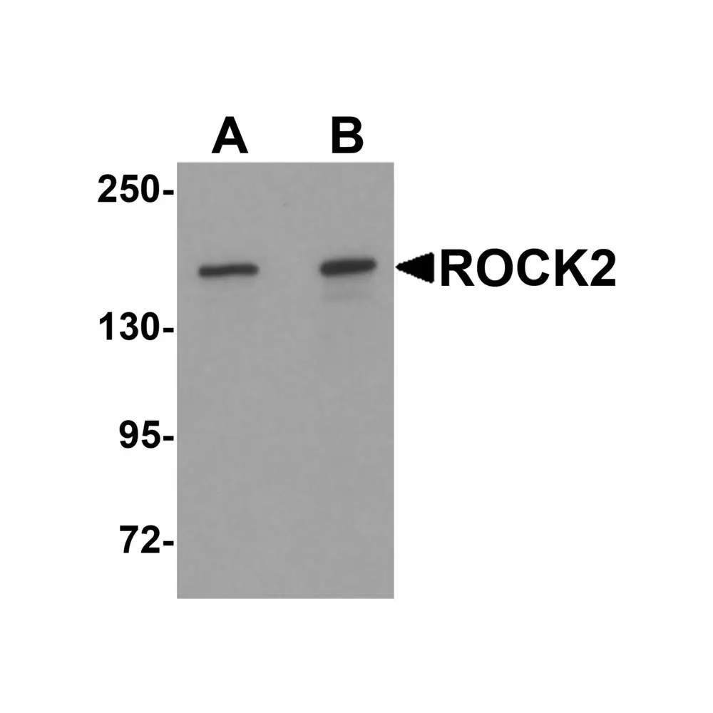 ProSci 6297_S ROCK2 Antibody, ProSci, 0.02 mg/Unit Primary Image