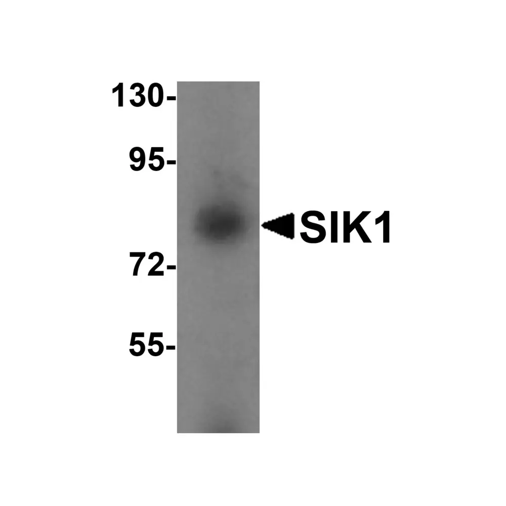 ProSci 6299 SIK1 Antibody, ProSci, 0.1 mg/Unit Primary Image