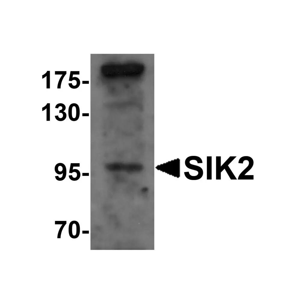 ProSci 6301_S SIK2 Antibody, ProSci, 0.02 mg/Unit Primary Image