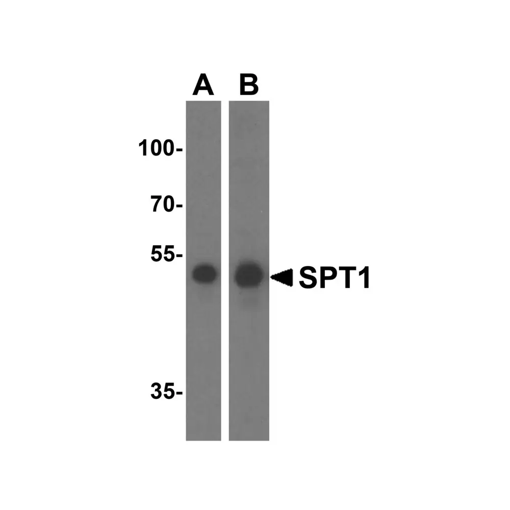 ProSci 6303_S SPT1 Antibody, ProSci, 0.02 mg/Unit Primary Image