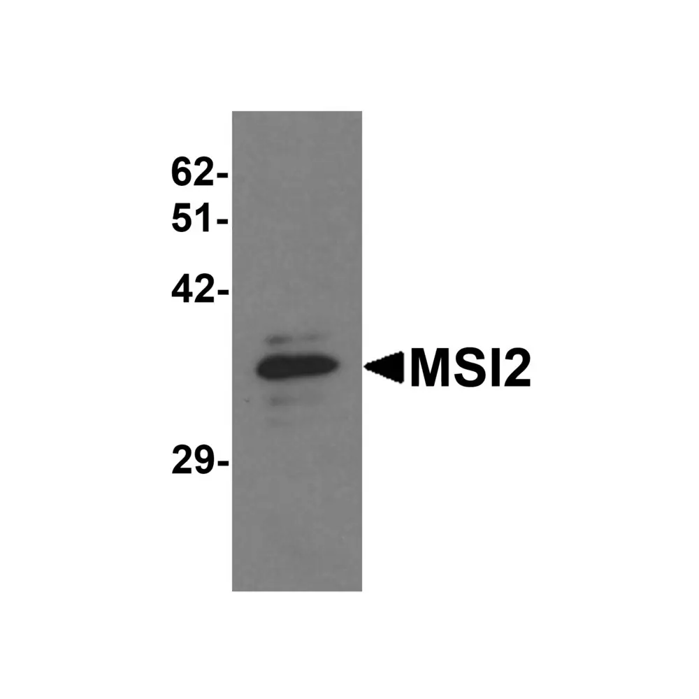 ProSci 6309 MSI2 Antibody, ProSci, 0.1 mg/Unit Primary Image