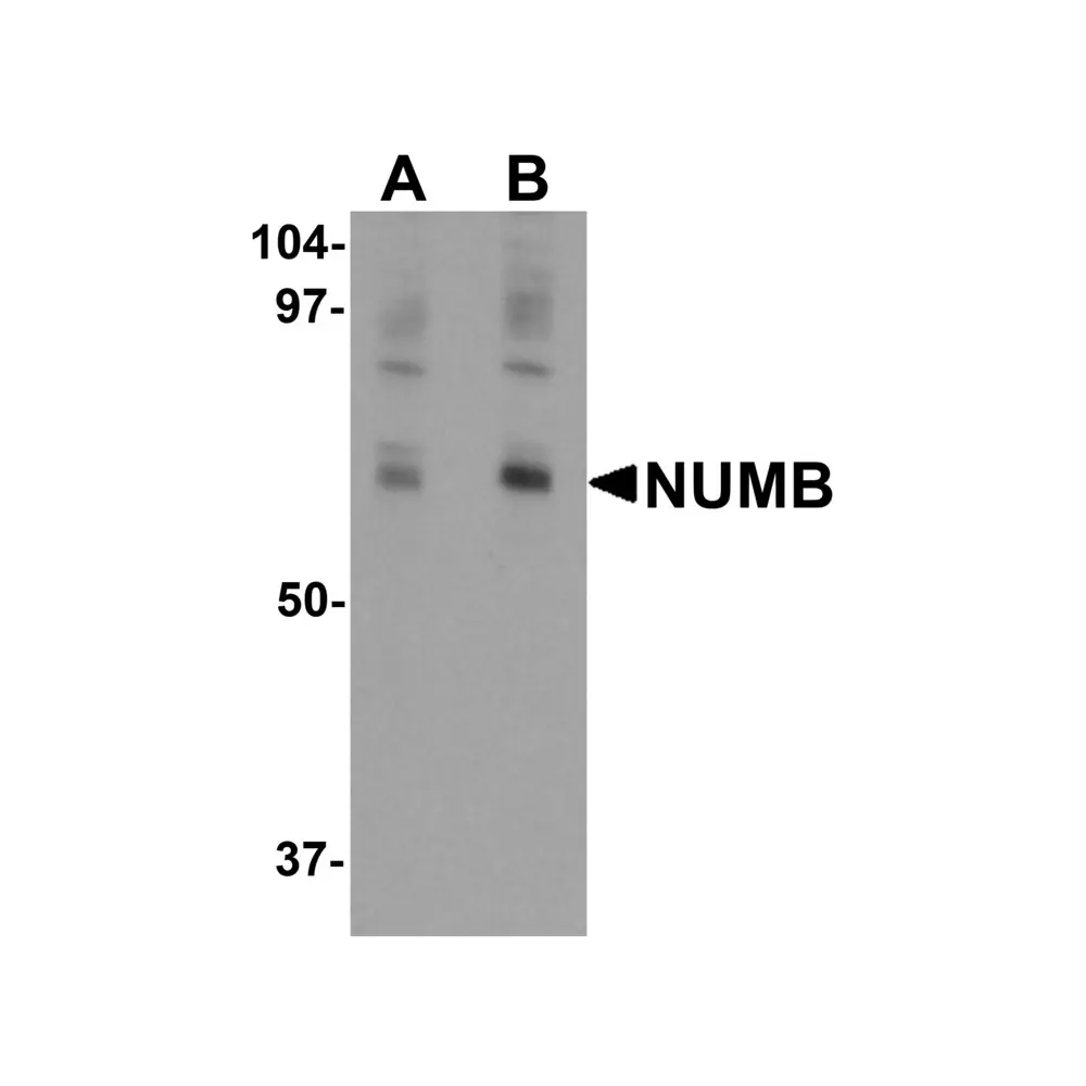 ProSci 6311_S NUMB Antibody, ProSci, 0.02 mg/Unit Primary Image