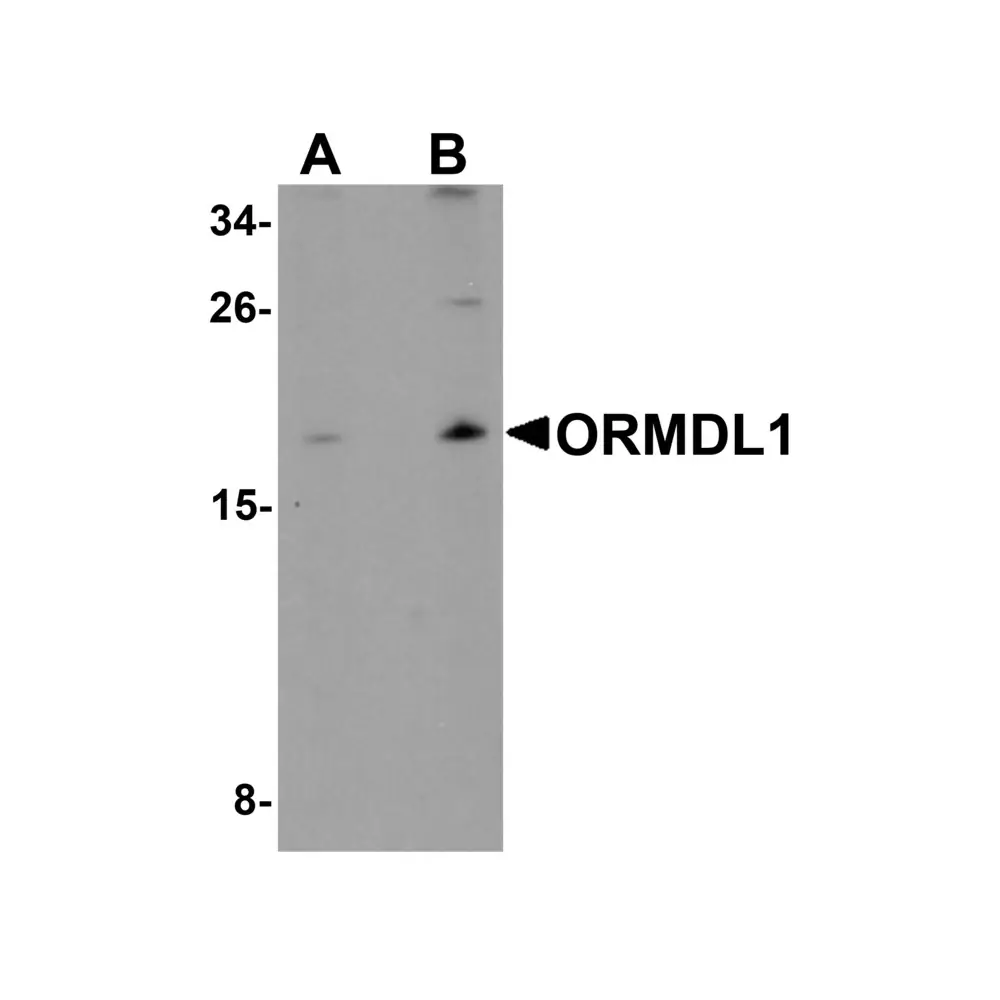 ProSci 6313 ORMDL1 Antibody, ProSci, 0.1 mg/Unit Primary Image