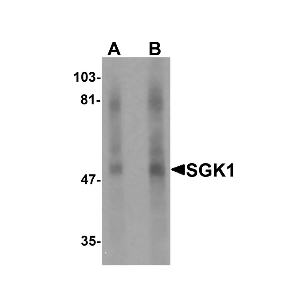 ProSci 6319 SGK1 Antibody, ProSci, 0.1 mg/Unit Primary Image