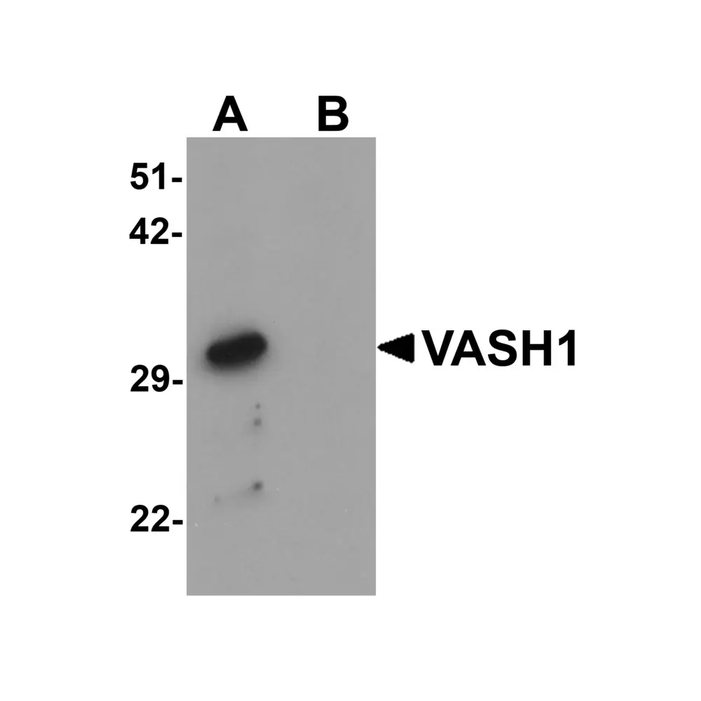 ProSci 6325 VASH1 Antibody, ProSci, 0.1 mg/Unit Primary Image