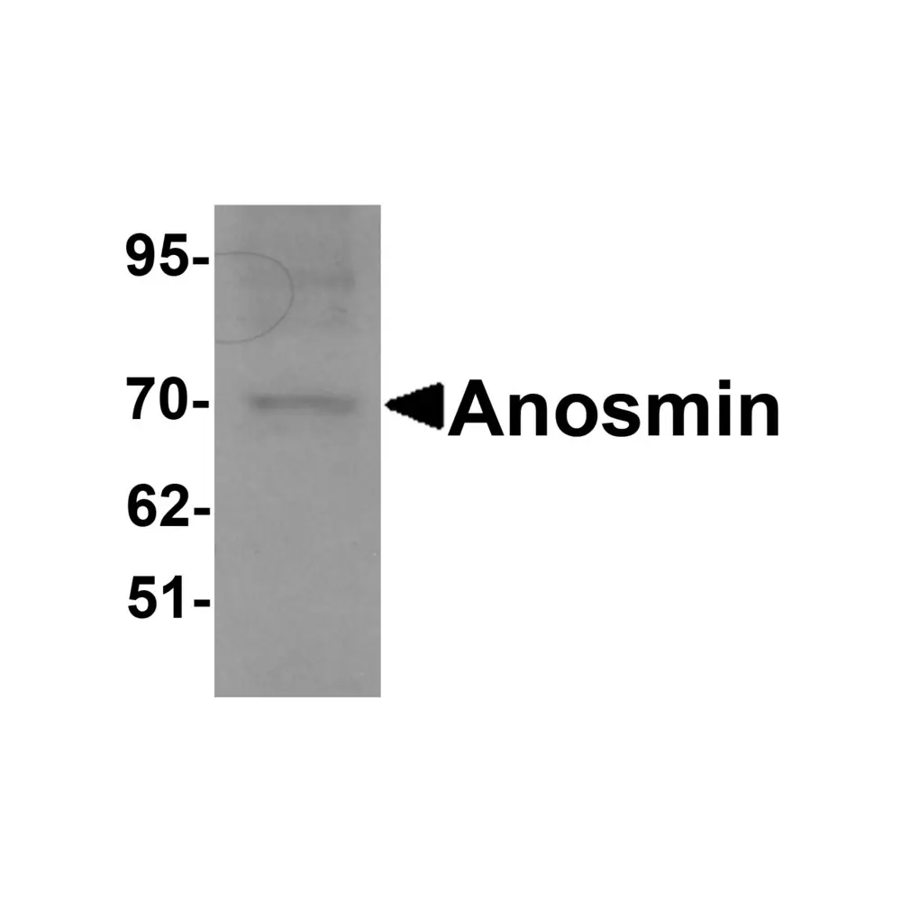 ProSci 6367_S Anosmin Antibody, ProSci, 0.02 mg/Unit Primary Image