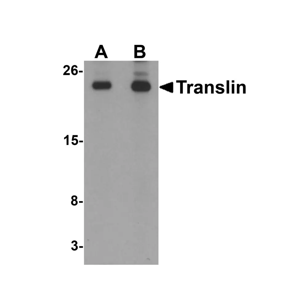 ProSci 6369 Translin Antibody, ProSci, 0.1 mg/Unit Primary Image