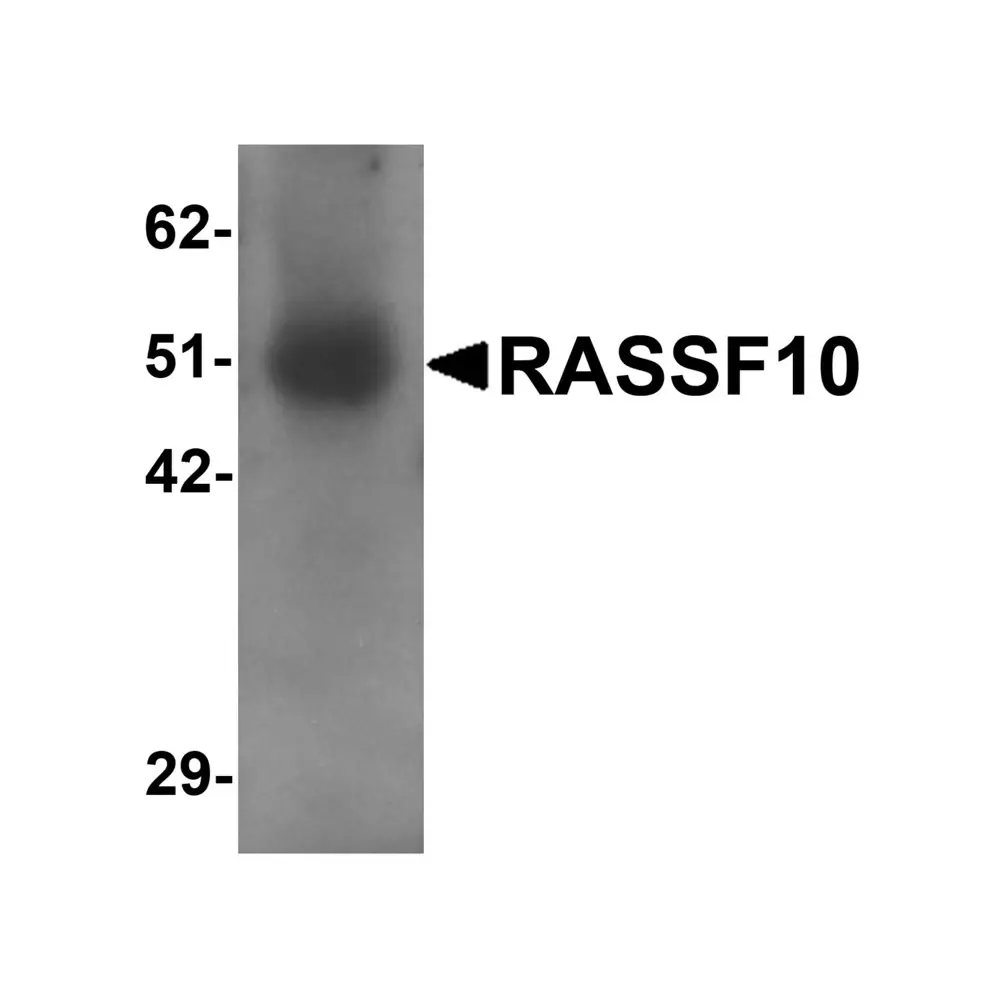 ProSci 6371 RASSF10 Antibody, ProSci, 0.1 mg/Unit Primary Image