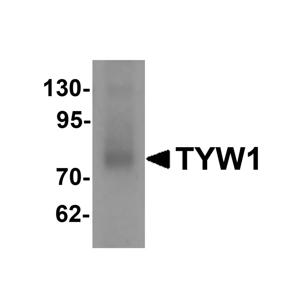 ProSci 6373 TYW1 Antibody, ProSci, 0.1 mg/Unit Primary Image