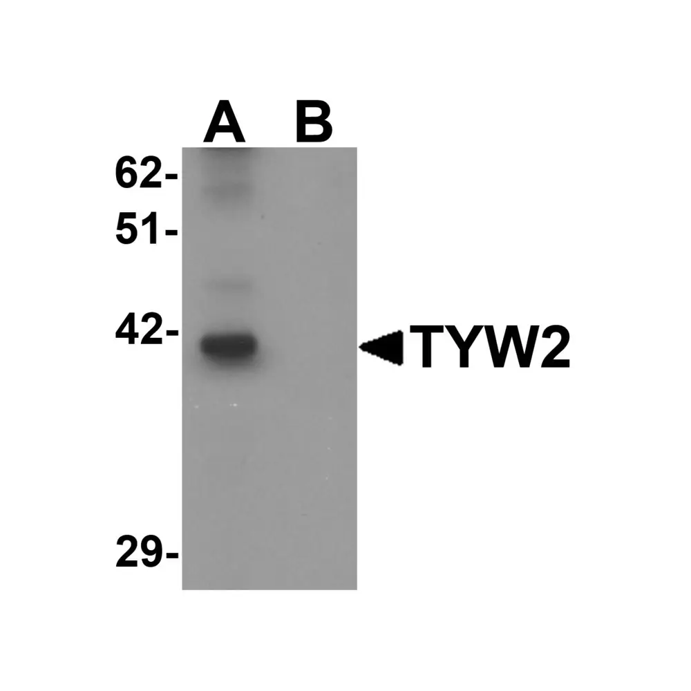ProSci 6375_S TYW2 Antibody, ProSci, 0.02 mg/Unit Primary Image