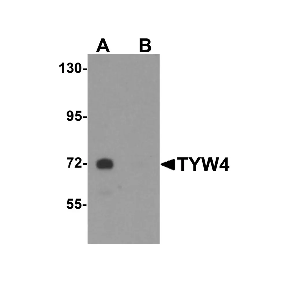 ProSci 6379 TYW4 Antibody, ProSci, 0.1 mg/Unit Primary Image