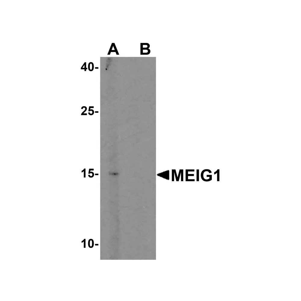 ProSci 6381_S MEIG1 Antibody, ProSci, 0.02 mg/Unit Primary Image