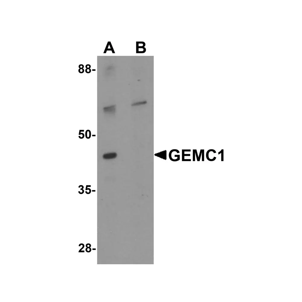 ProSci 6385 GEMC1 Antibody, ProSci, 0.1 mg/Unit Primary Image