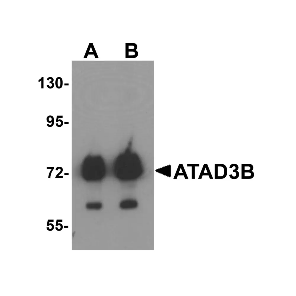 ProSci 6389 ATAD3B Antibody, ProSci, 0.1 mg/Unit Primary Image