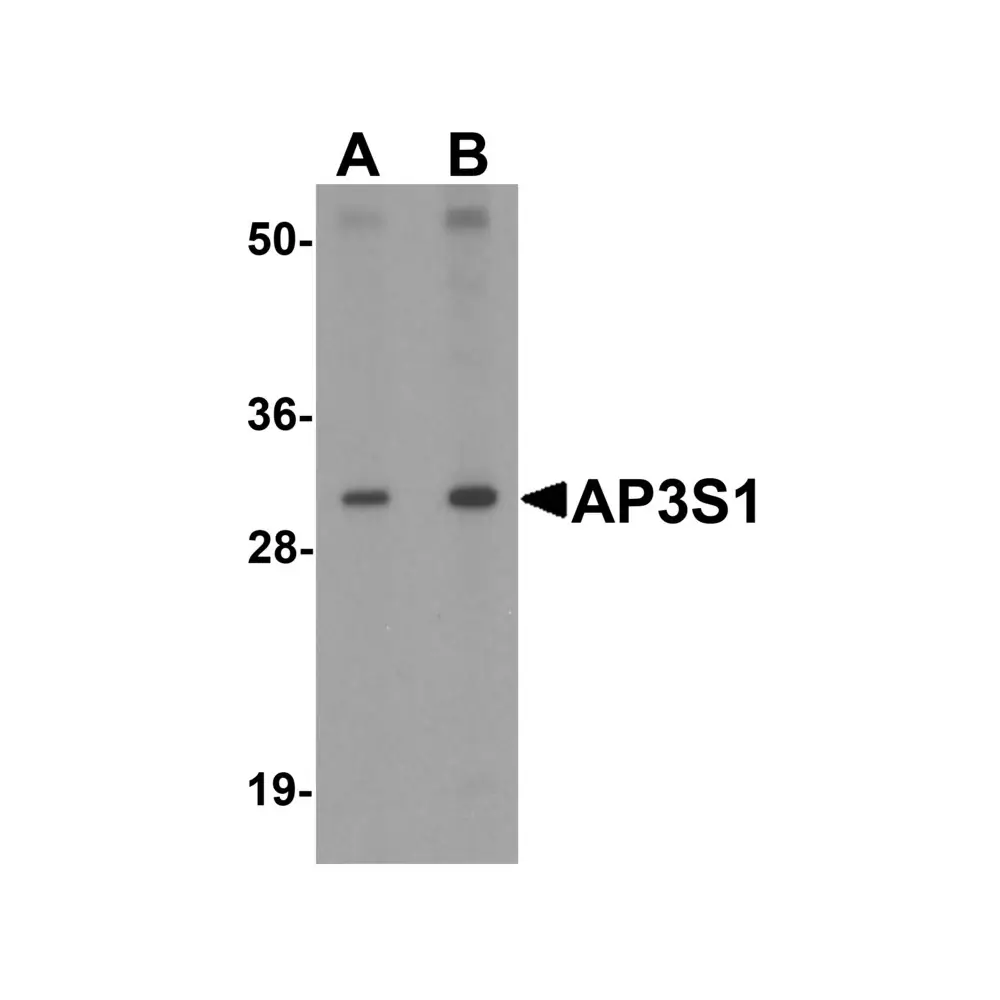 ProSci 6391 AP3S1 Antibody, ProSci, 0.1 mg/Unit Primary Image
