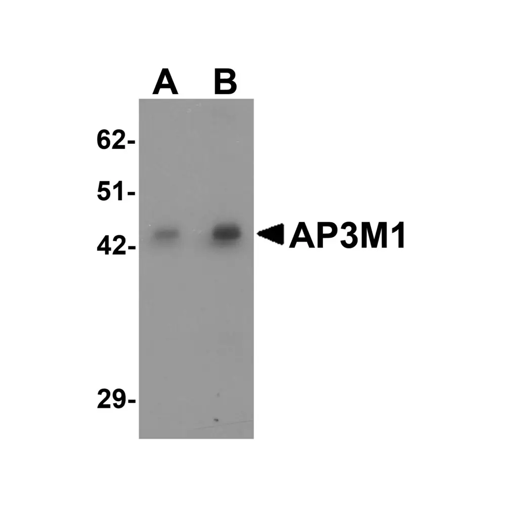 ProSci 6393 AP3M1 Antibody, ProSci, 0.1 mg/Unit Primary Image