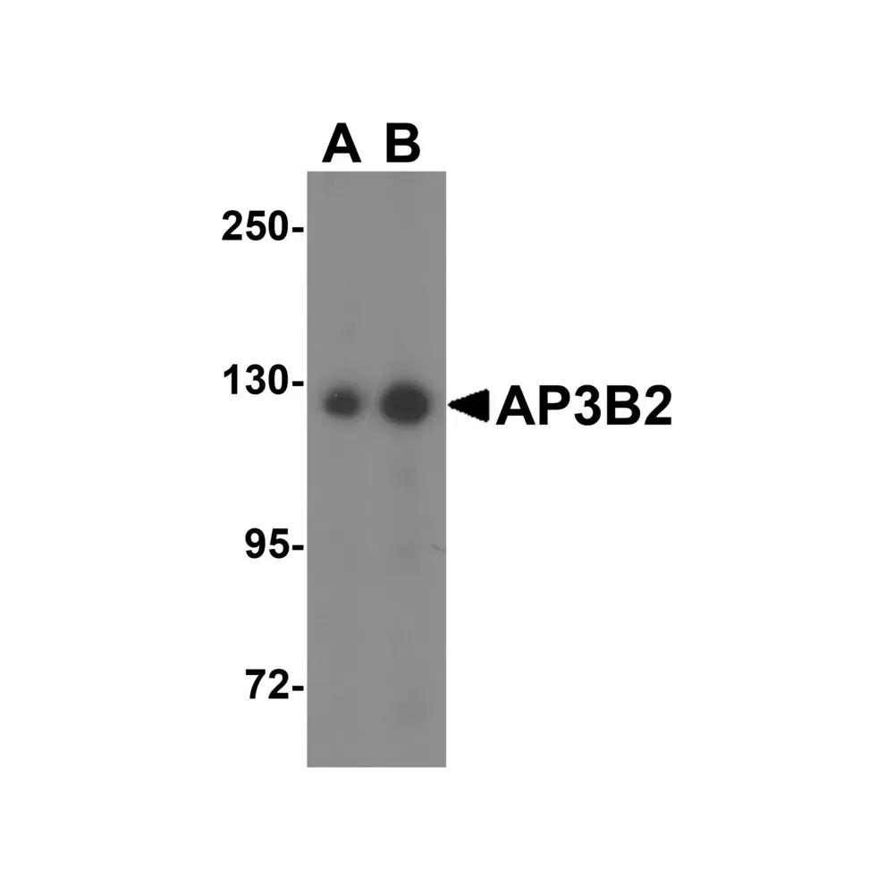 ProSci 6395_S AP3B2 Antibody, ProSci, 0.02 mg/Unit Primary Image