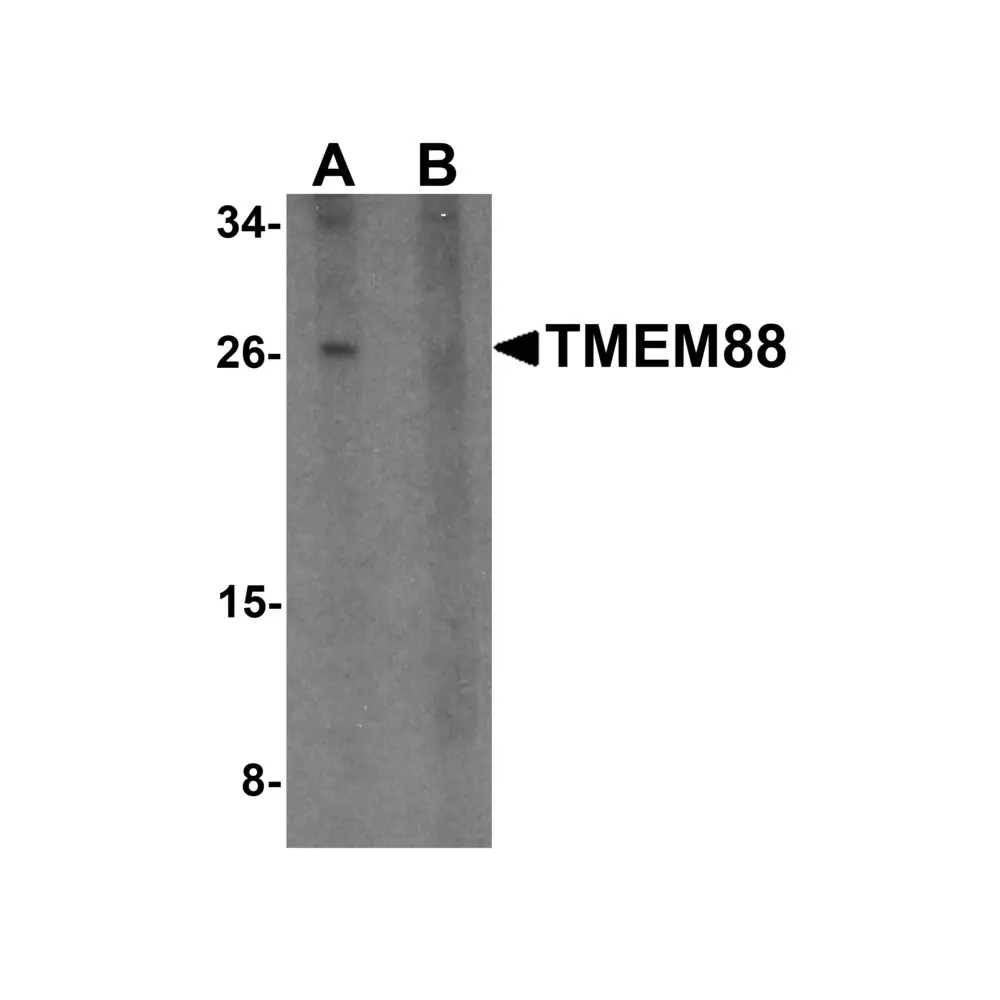 ProSci 6397 TMEM88 Antibody, ProSci, 0.1 mg/Unit Primary Image