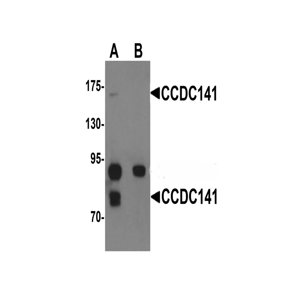 ProSci 6399 CCDC141 Antibody, ProSci, 0.1 mg/Unit Primary Image
