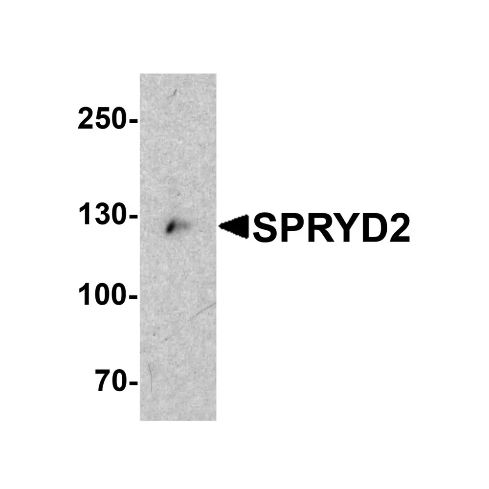ProSci 6403_S SPRYD2 Antibody, ProSci, 0.02 mg/Unit Primary Image
