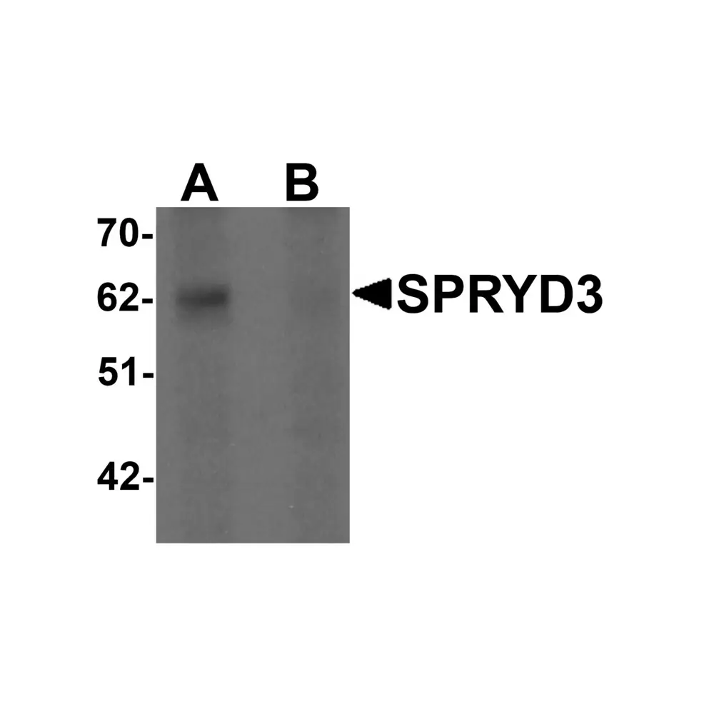 ProSci 6405 SPRYD3 Antibody, ProSci, 0.1 mg/Unit Primary Image