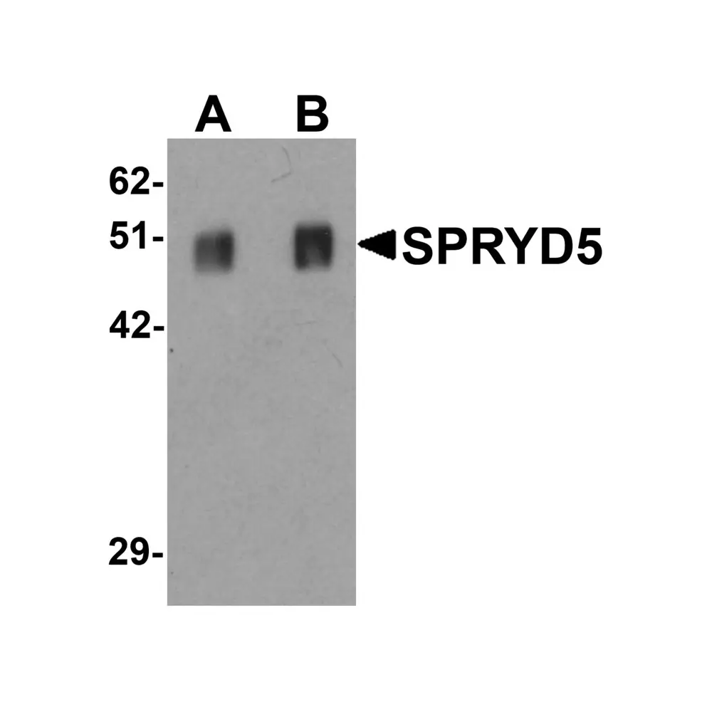 ProSci 6409_S SPRYD5 Antibody, ProSci, 0.02 mg/Unit Primary Image