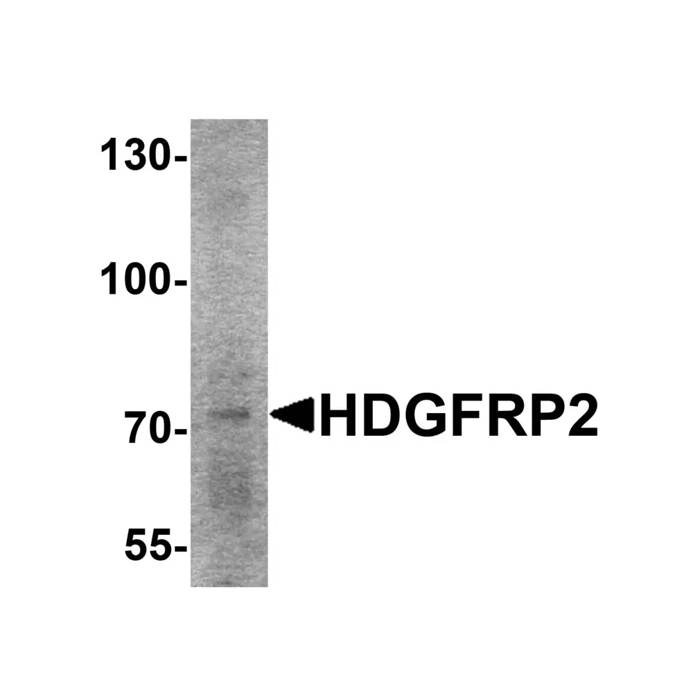 ProSci 6411 HDGFRP2 Antibody, ProSci, 0.1 mg/Unit Primary Image