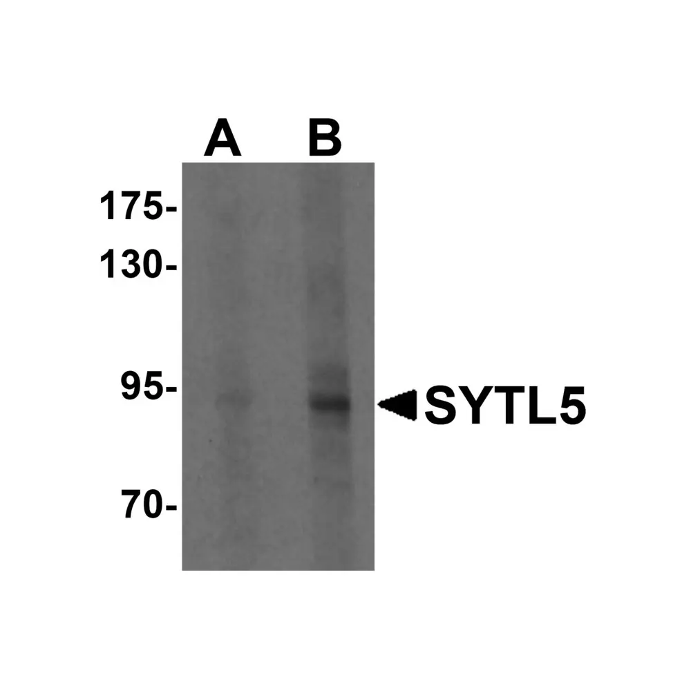 ProSci 6413 SYTL5 Antibody, ProSci, 0.1 mg/Unit Primary Image