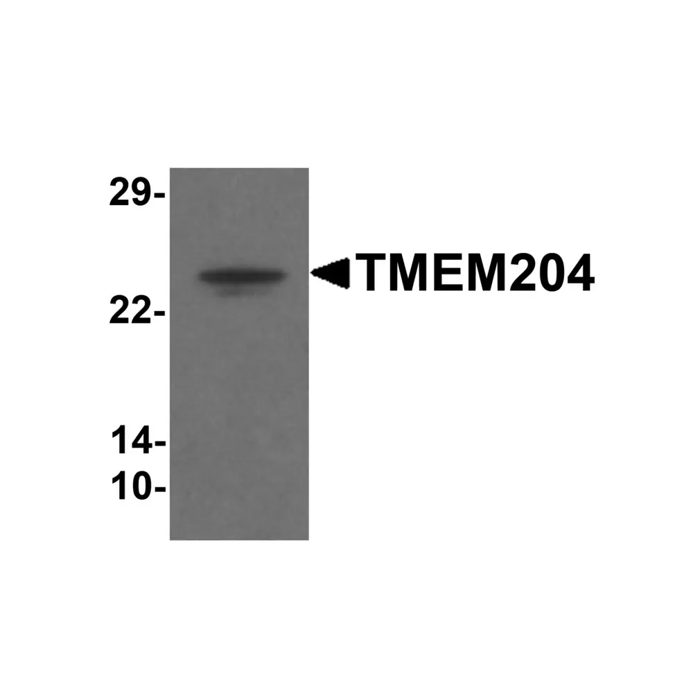 ProSci 6415_S TMEM204 Antibody, ProSci, 0.02 mg/Unit Primary Image
