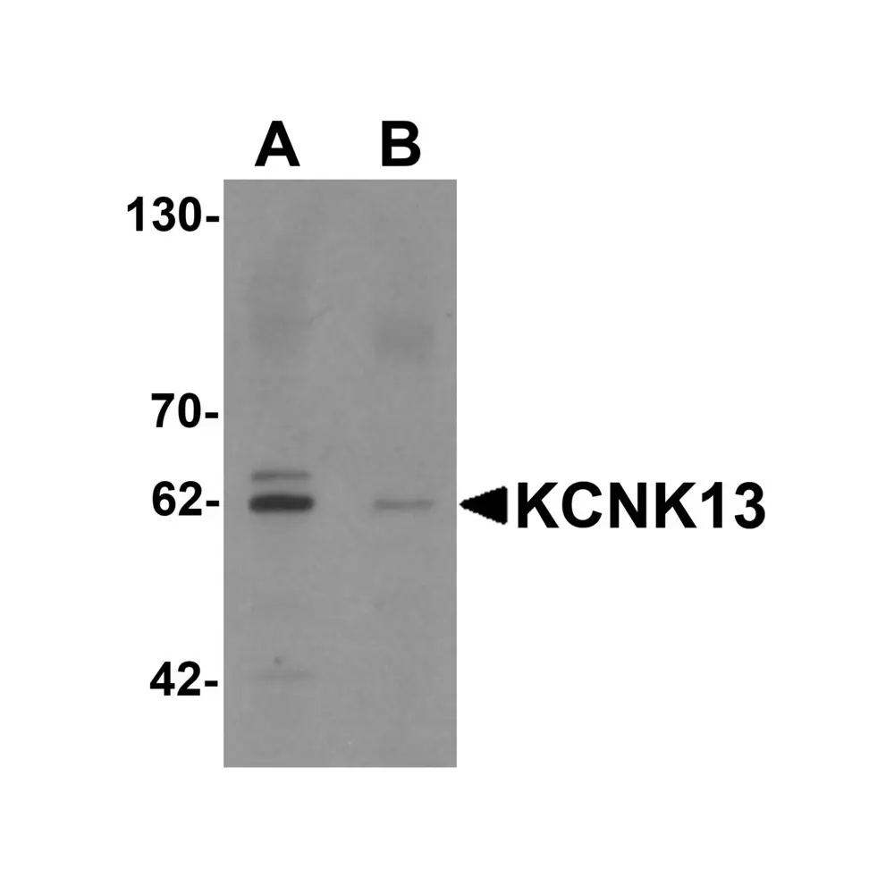 ProSci 6423 KCNK13 Antibody, ProSci, 0.1 mg/Unit Primary Image