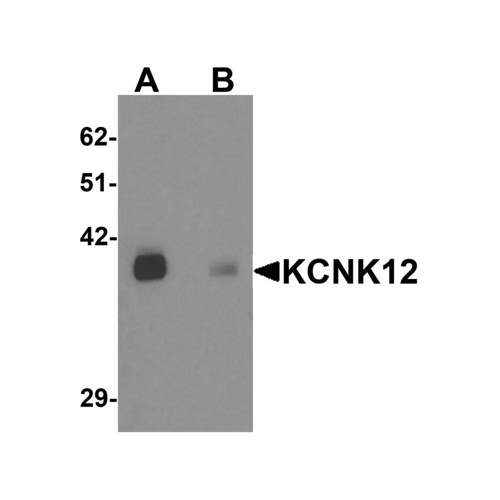 ProSci 6425 KCNK12 Antibody, ProSci, 0.1 mg/Unit Primary Image
