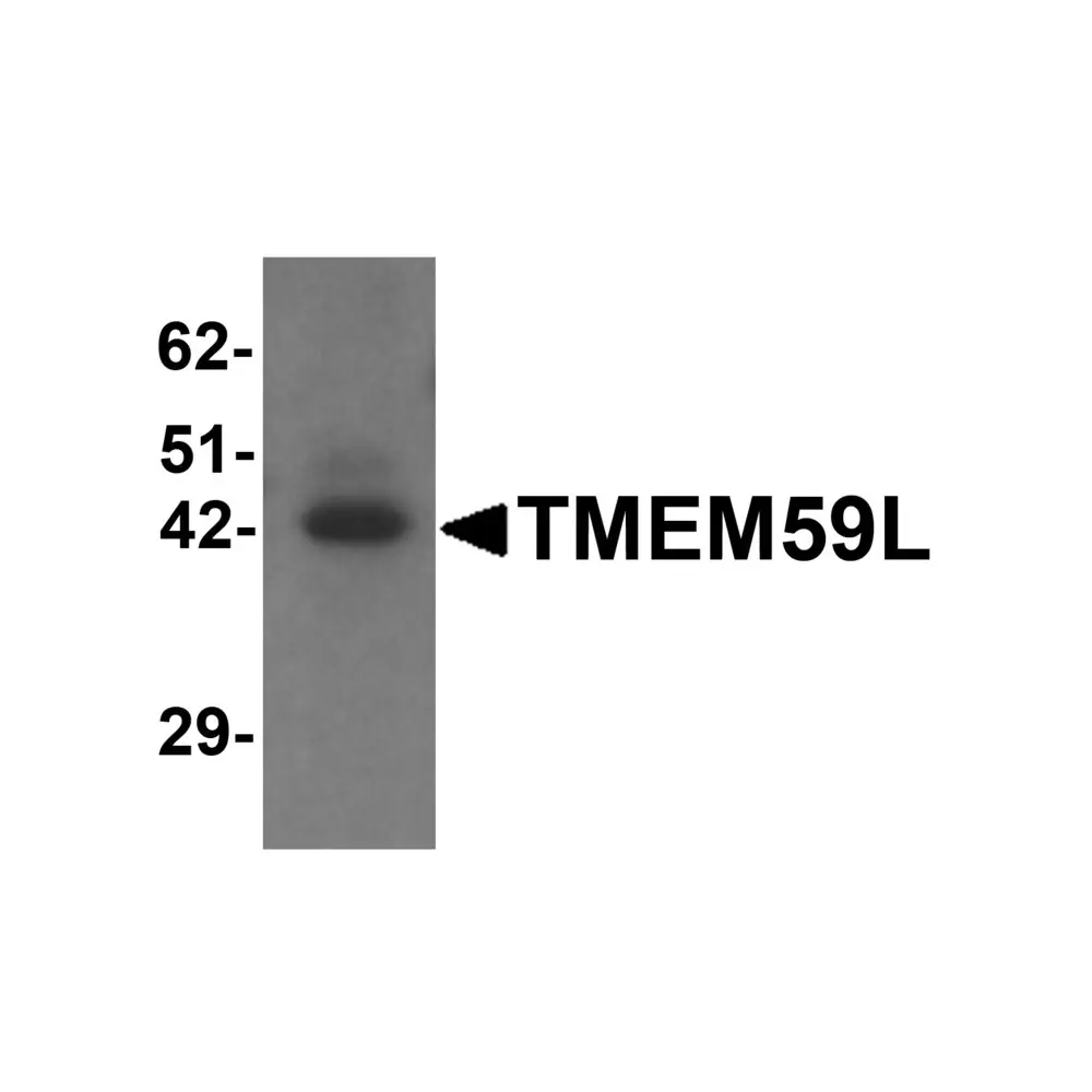 ProSci 6435 TMEM59L Antibody, ProSci, 0.1 mg/Unit Primary Image
