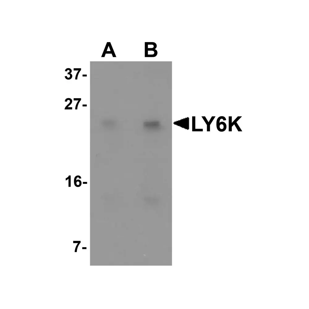 ProSci 6437 LY6K Antibody, ProSci, 0.1 mg/Unit Primary Image