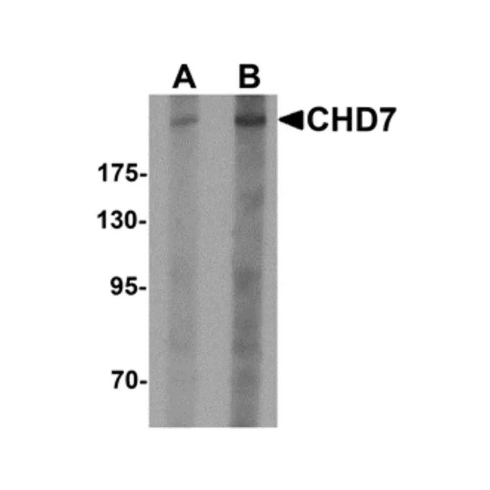 ProSci 6441 CHD7 Antibody, ProSci, 0.1 mg/Unit Primary Image