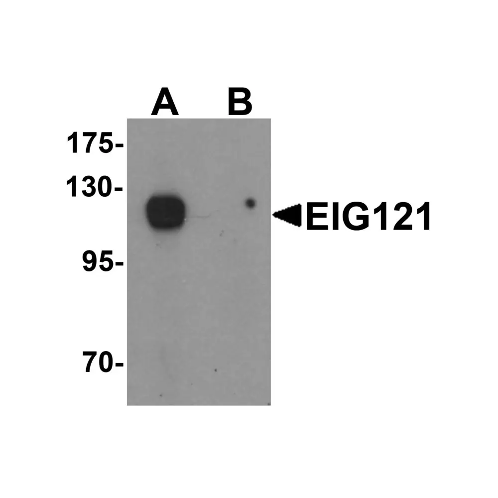 ProSci 6443 EIG121 Antibody, ProSci, 0.1 mg/Unit Primary Image