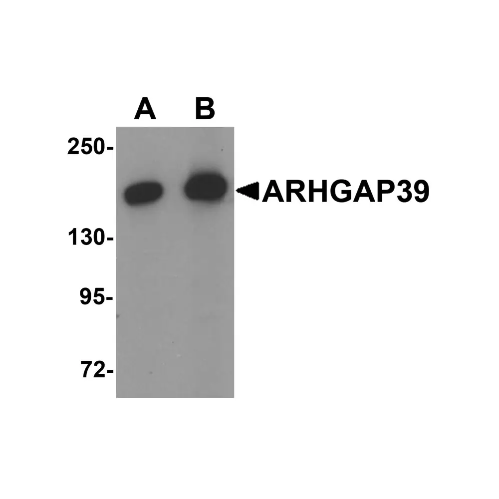 ProSci 6445_S ARHGAP39 Antibody, ProSci, 0.02 mg/Unit Primary Image
